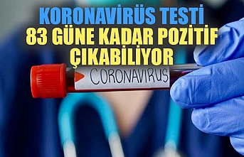 Koronavirüs testi 83 güne kadar pozitif çıkabiliyor